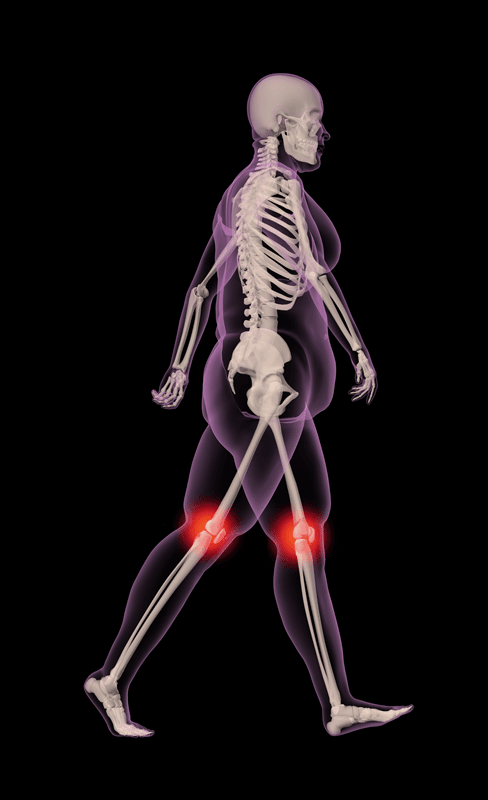joint pain concept of skeleton